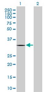 ZNF511 Antibody in Western Blot (WB)