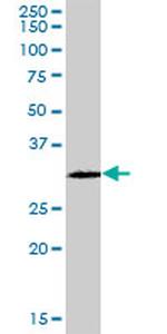 GSTO2 Antibody in Western Blot (WB)