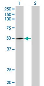 CYP2R1 Antibody in Western Blot (WB)