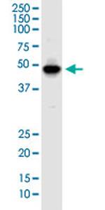 IKIP Monoclonal Antibody (2D5)