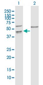 PPIL5 Polyclonal Antibody, MaxPab™