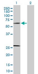 SOCS4 Polyclonal Antibody, MaxPab™