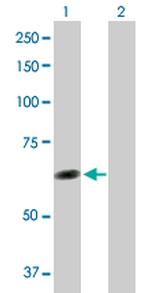 TTC8 Polyclonal Antibody, MaxPab™