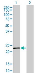 SENP8 Antibody in Western Blot (WB)