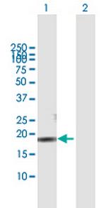CMTM3 Polyclonal Antibody, MaxPab™
