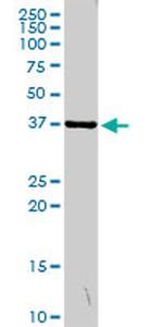 MSI2 Antibody in Western Blot (WB)