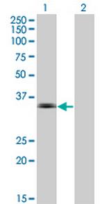 MSI2 Monoclonal Antibody (2D7)