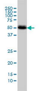 CANT1 Monoclonal Antibody (2D3)