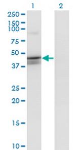 CANT1 Monoclonal Antibody (1A1)