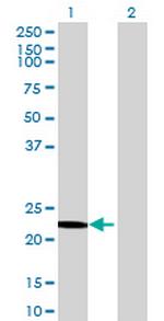 OVCA2 Polyclonal Antibody, MaxPab™