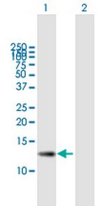 ZSWIM7 Polyclonal Antibody, MaxPab™