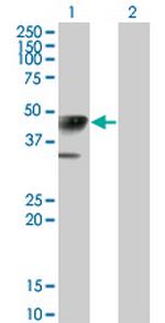 CALR3 Monoclonal Antibody (4E3)