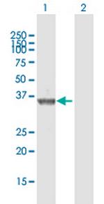 TMIGD2 Antibody in Western Blot (WB)