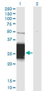 ZNF428 Monoclonal Antibody (3H4)