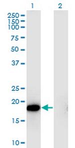 HSPB6 Monoclonal Antibody (6A4)