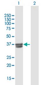 B3GALT6 Polyclonal Antibody, MaxPab™