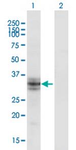 B3GALT6 Monoclonal Antibody (3E5)