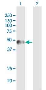 ZNF684 Antibody in Western Blot (WB)