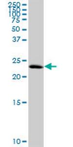 C1orf83 Polyclonal Antibody, MaxPab™