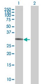 UHMK1 Polyclonal Antibody, MaxPab™