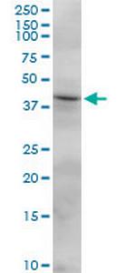FCRLB Polyclonal Antibody, MaxPab™