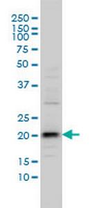 C20orf102 Monoclonal Antibody (3B9)