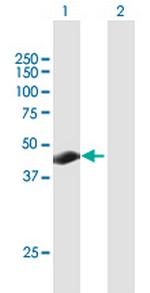 TSPYL3 Polyclonal Antibody, MaxPab™
