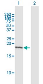 TBN Polyclonal Antibody, MaxPab™