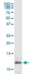 DNAJC19 Polyclonal Antibody, MaxPab™