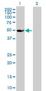 GLYCTK Antibody in Western Blot (WB)
