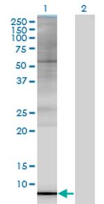 ARL9 Antibody in Western Blot (WB)