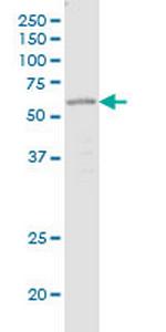 OTOP1 Antibody in Western Blot (WB)