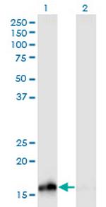 NUDCD2 Monoclonal Antibody (3C1)