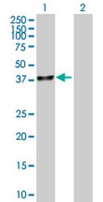 UBLCP1 Polyclonal Antibody, MaxPab™