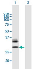 RAET1E Polyclonal Antibody, MaxPab™