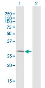 WBSCR28 Polyclonal Antibody, MaxPab™