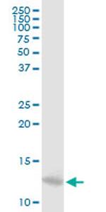 MTPN Antibody in Western Blot (WB)