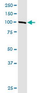 LRGUK Antibody in Western Blot (WB)