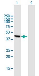 ADHFE1 Polyclonal Antibody, MaxPab™