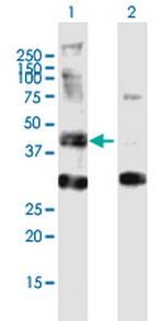 AGPAT6 Polyclonal Antibody, MaxPab™