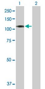 CXorf20 Polyclonal Antibody, MaxPab™
