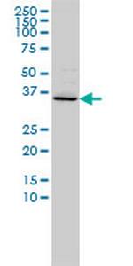 FOXR2 Monoclonal Antibody (2C1)