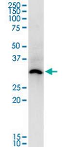 ASB5 Monoclonal Antibody (6B10)