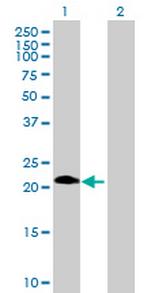 ASB6 Polyclonal Antibody, MaxPab™