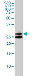 ASB9 Monoclonal Antibody (1D8)