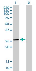 MYL6B Polyclonal Antibody, MaxPab™