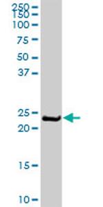 MYL6B Antibody in Western Blot (WB)
