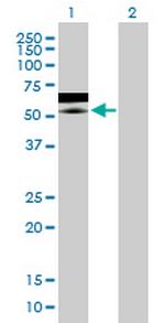 ZNF358 Antibody in Western Blot (WB)