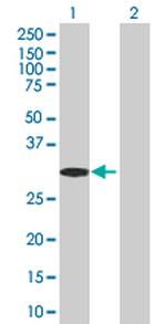 RNF32 Antibody in Western Blot (WB)