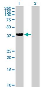 ZFP28 Antibody in Western Blot (WB)